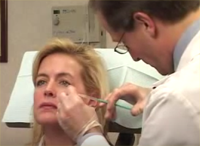 Botox NYC for Crows feet