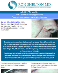 Ron Shelton MD Newsletter on Skin Cancer