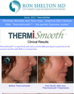 June 2017 - ThermiSmooth for Summer
