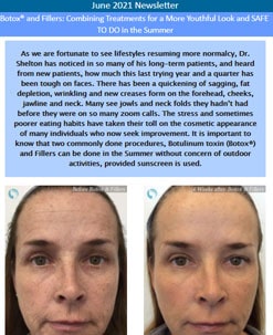 Botox® and Fillers
