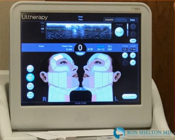 ultherapy facelift nyc