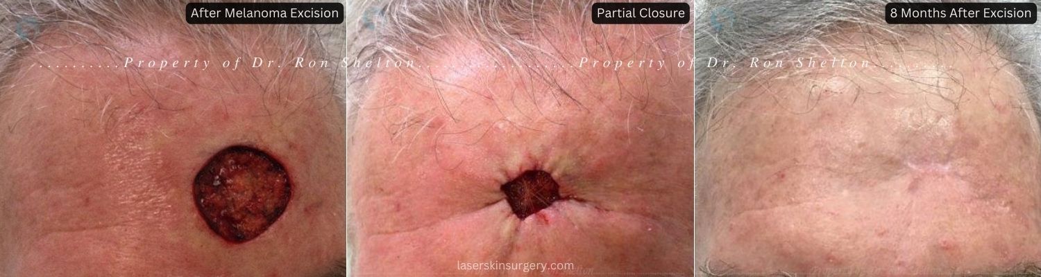 Swelling | Moles | Plastic surgery - AMICUS CLINIC