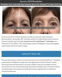 brow lift with coolsculpting